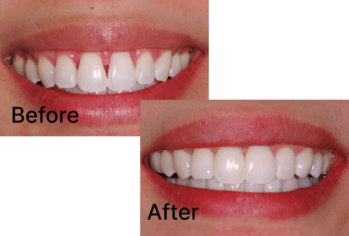 Bioclear case study: Before / After