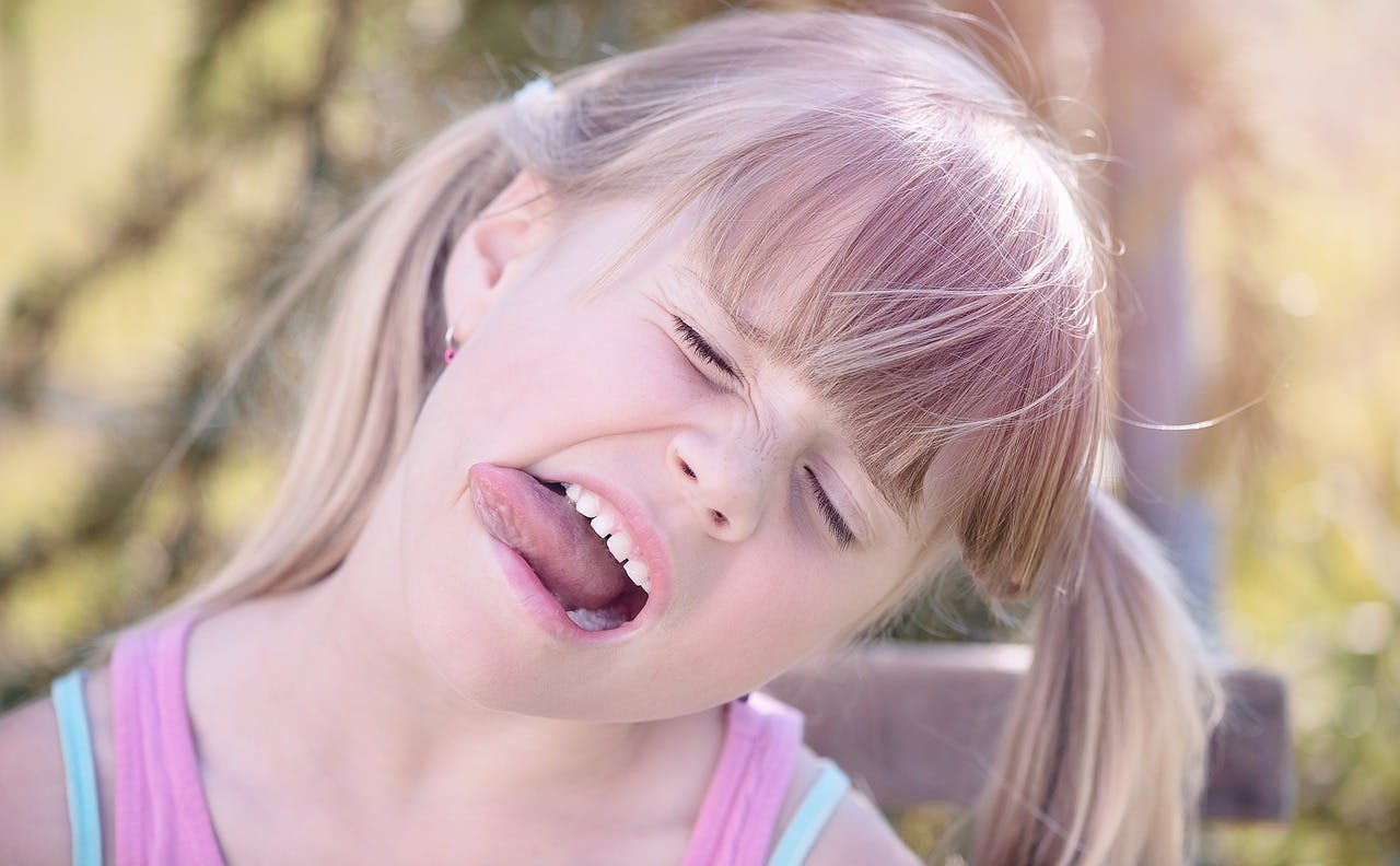 Beyond Infancy: Recognizing and Addressing Tongue Tie in Adults