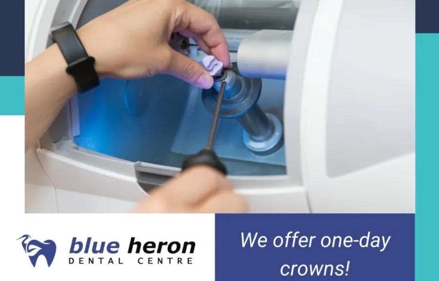 We offer one-day crowns